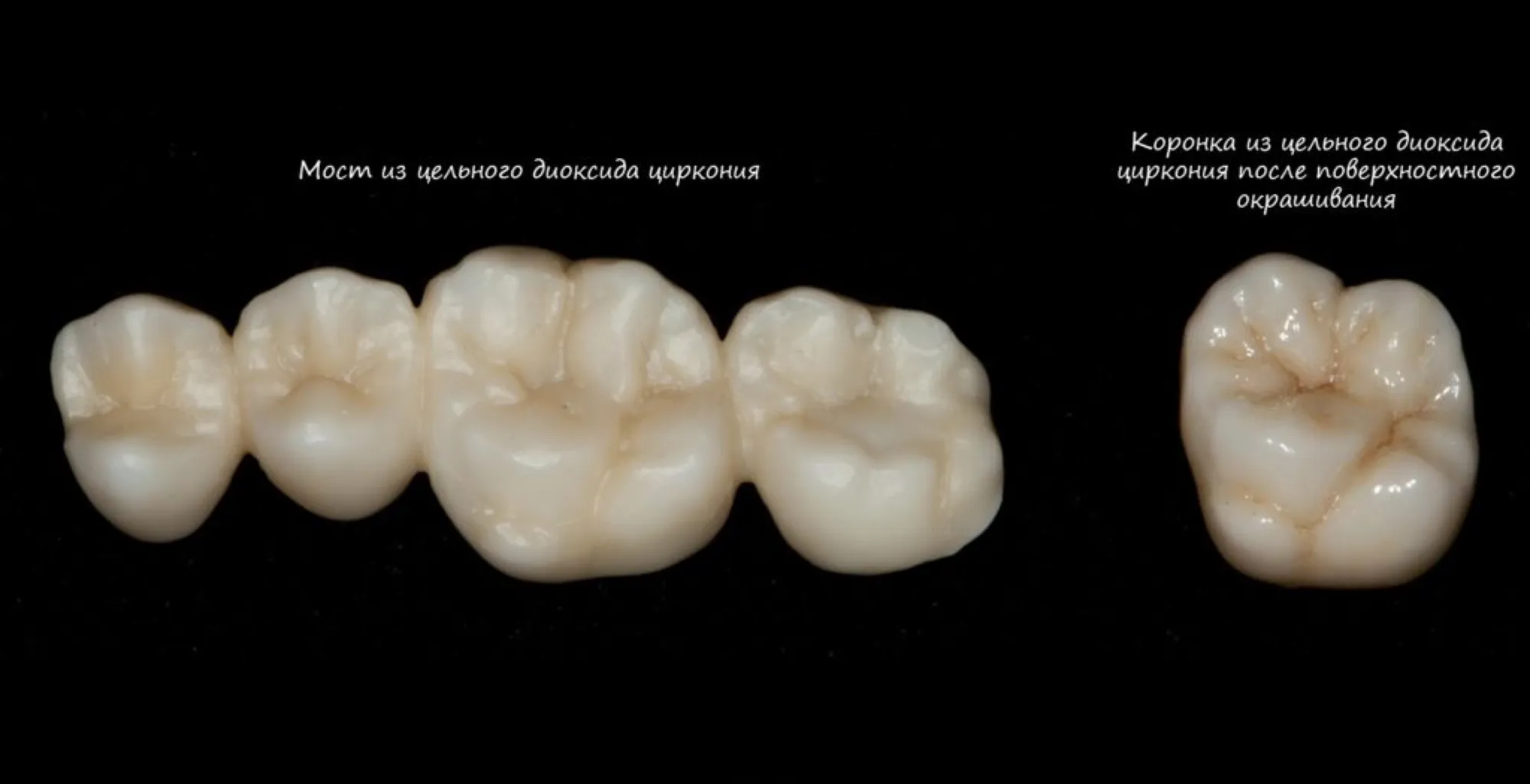 диоксид циркония коронки