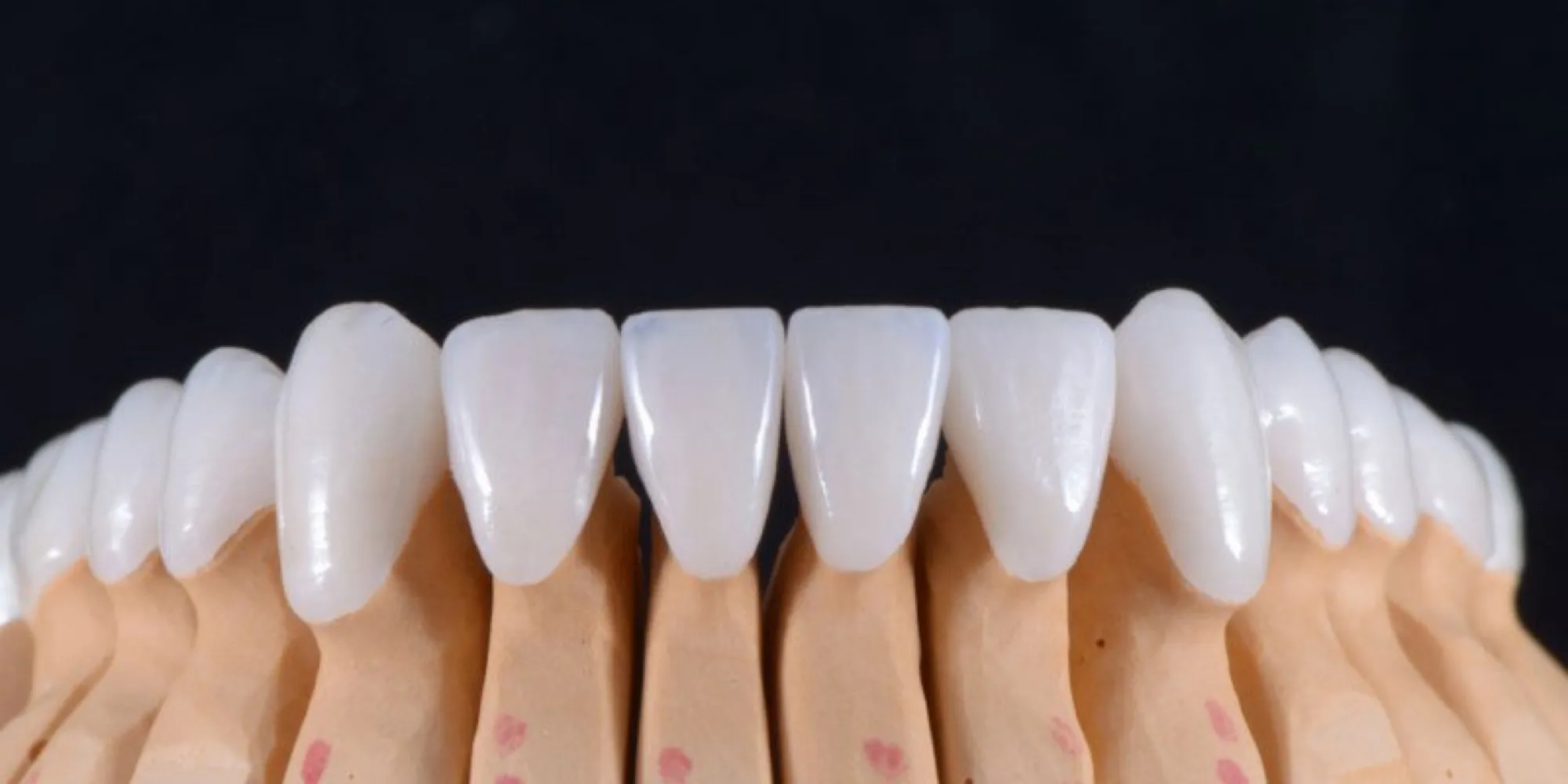 керамические виниры